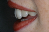 Lippenprofil von links