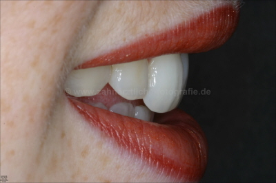 Lippenprofil von rechts